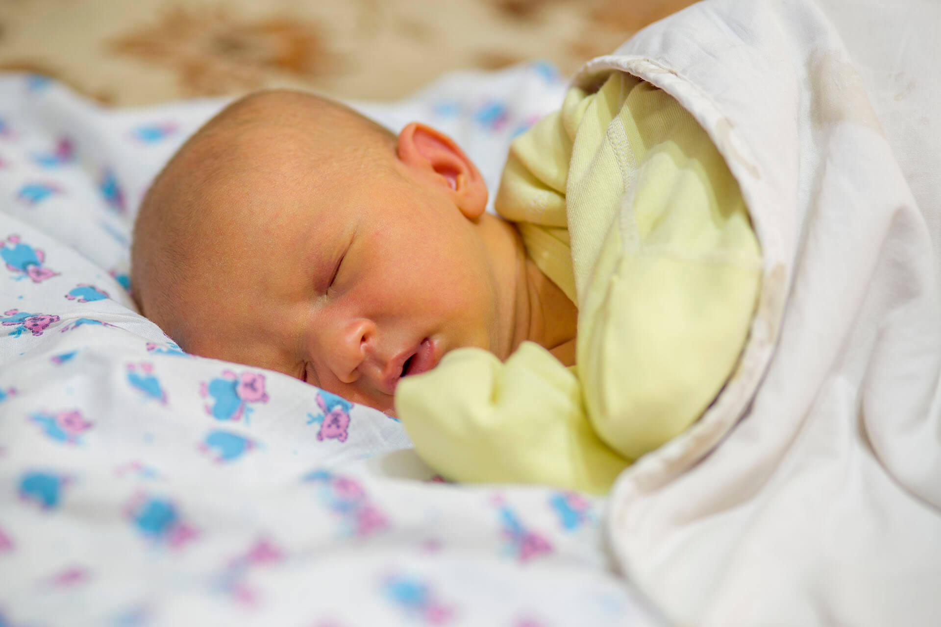 Jaundice in Babies - Paediatrician Singapore